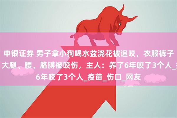 申银证券 男子拿小狗喝水盆浇花被追咬，衣服裤子都破了，屁股、大腿、腰、胳膊被咬伤，主人：养了6年咬了3个人_疫苗_伤口_网友